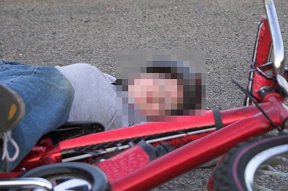 12-letni rowerzysta z wkrcon w szprychy rk - pomogli mu straacy